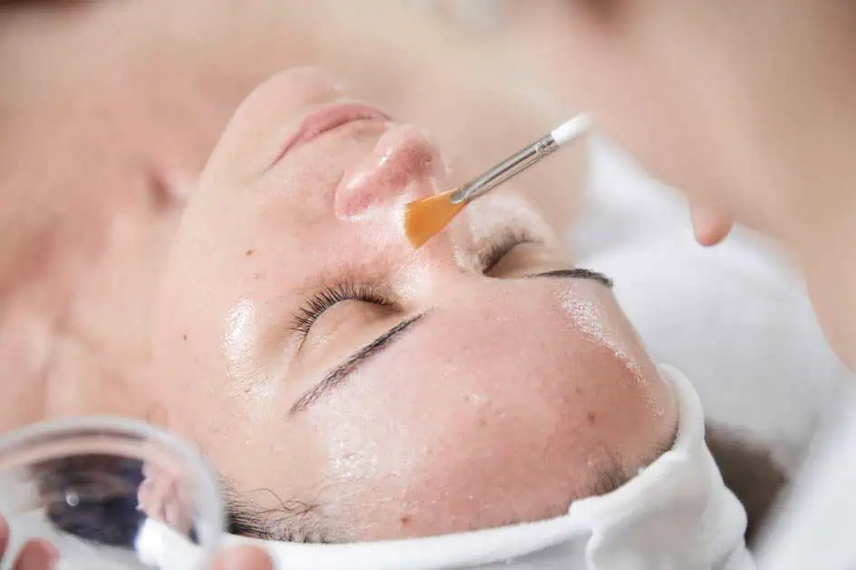 Chemical Peels in Northridge, CA by ATMA MSIM INC