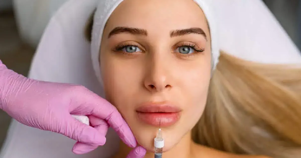 woman receiving a lip filler injection in Northridge, CA (1)