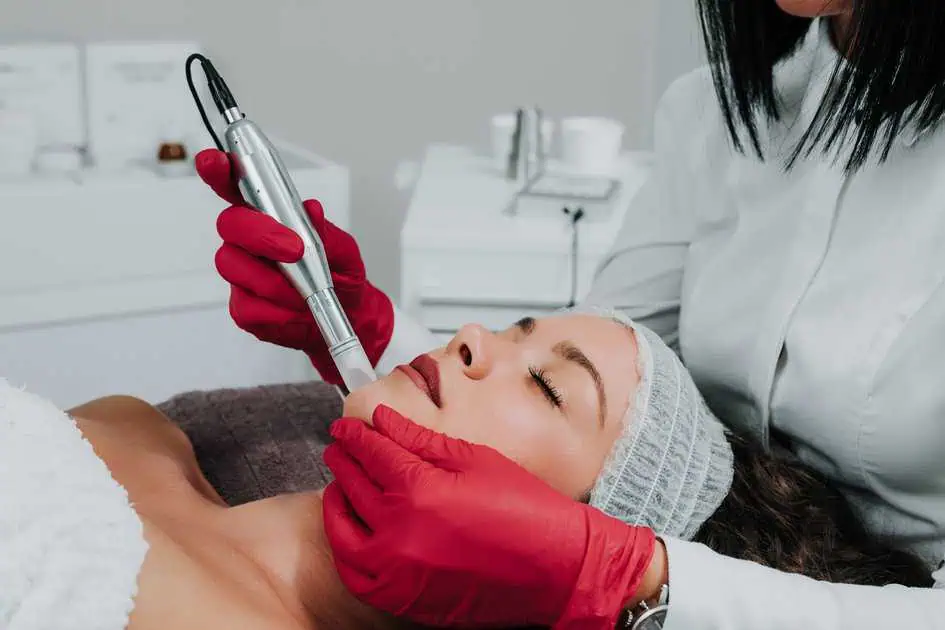 Microneedling Treatment In Northridge, CA by Atma Health